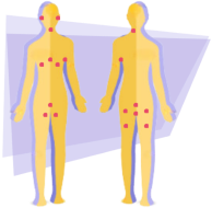 illustration localisations aisselles aine zones perianales zones perineales