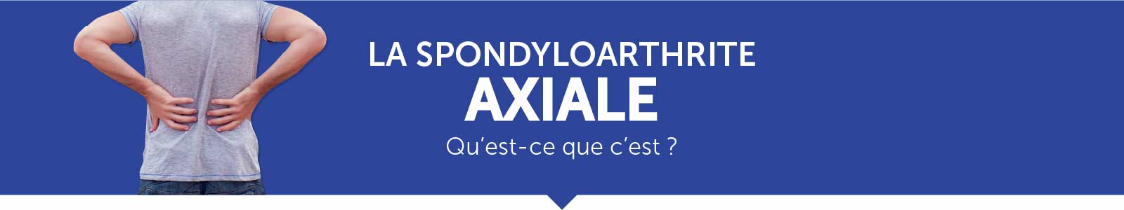 La spondyloarthrite axiale, qu'est-ce que c'est ? 