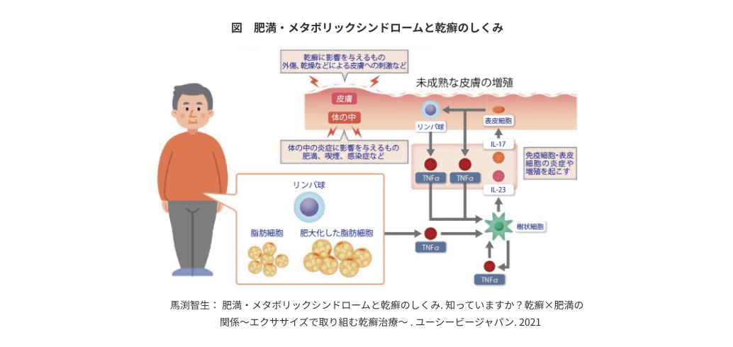 図 肥満・メタボリックシンドロームと乾癬のしくみ