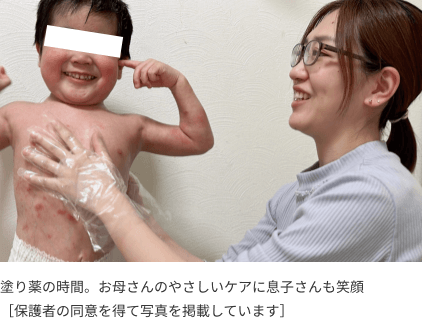 塗り薬の時間。お母さんのやさしいケアに息子さんも笑顔［保護者の同意を得て写真を掲載しています］