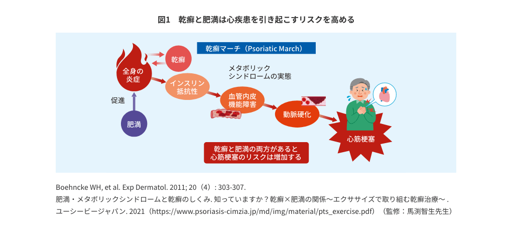 図1 乾癬と肥満は心疾患を引き起こすリスクを高める