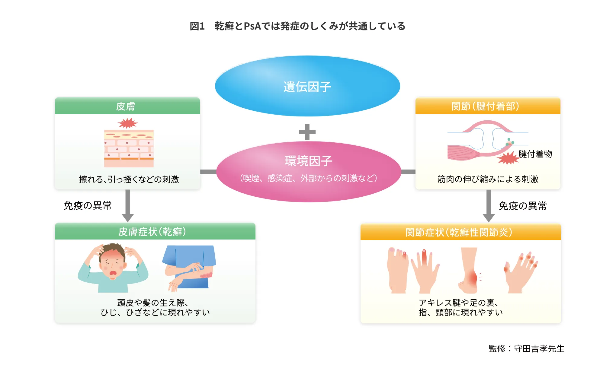 図1 乾癬とPsAでは発症のしくみが共通している