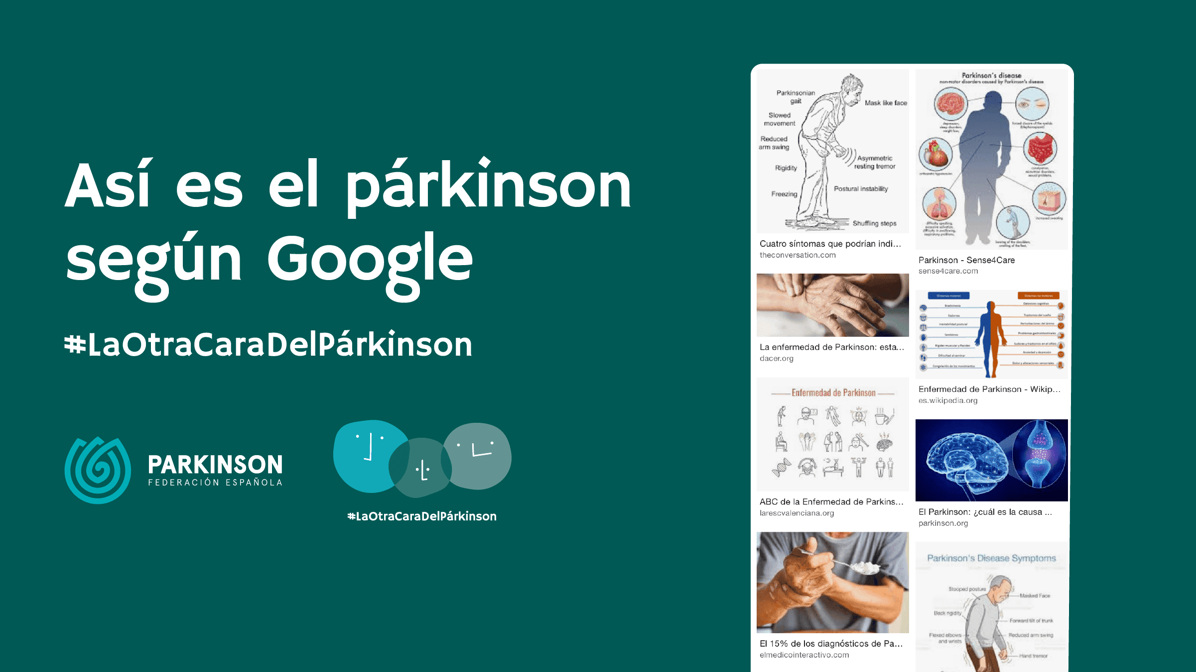 parkinson