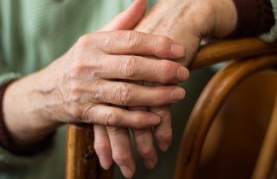 Psoriasis 